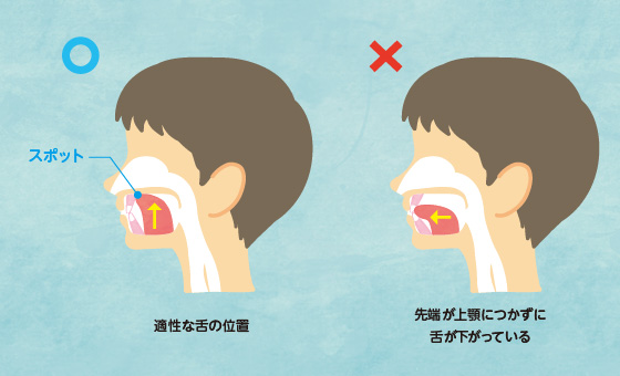 本来、舌はどの位置にあるべきなんですか？